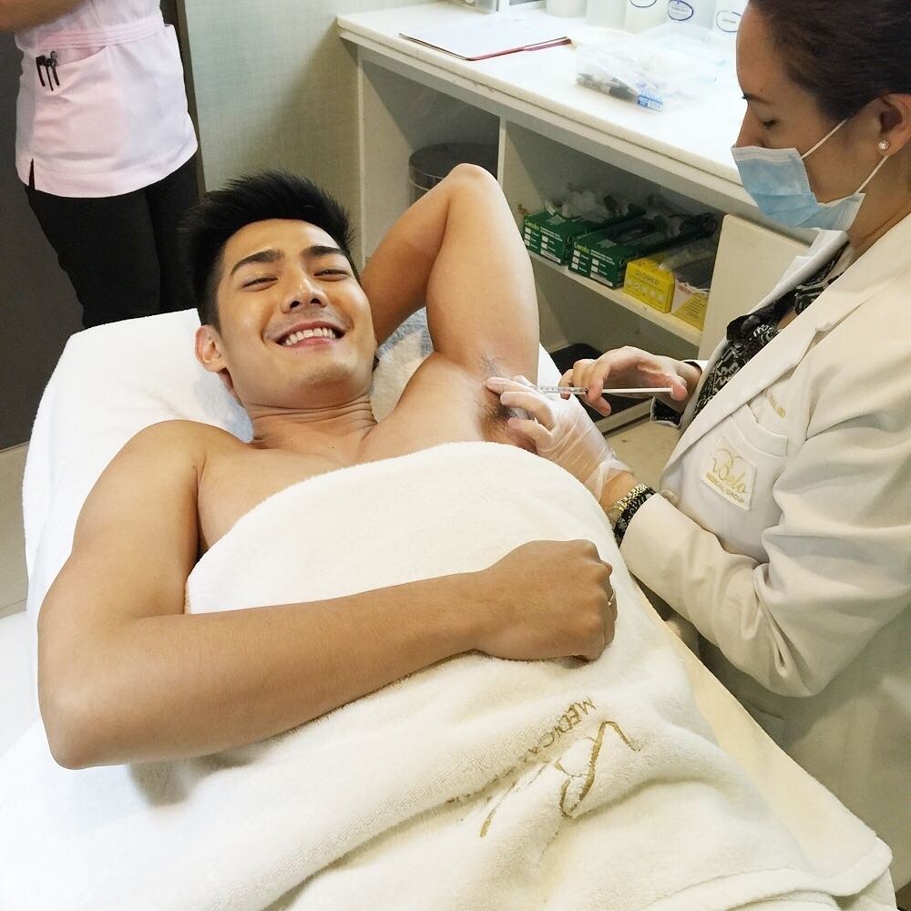 Robi Domingo gets Underarm Botox
