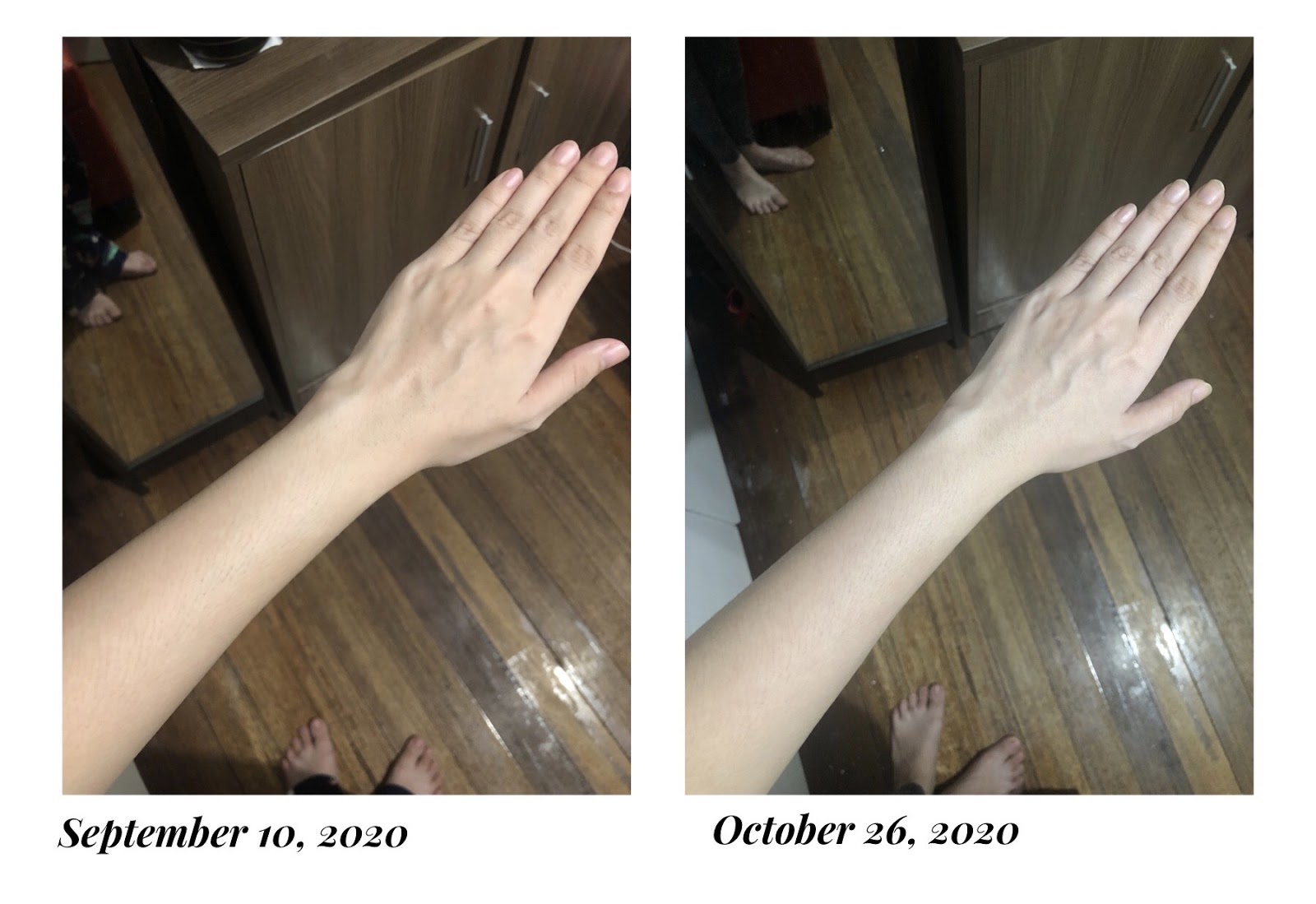 Andrea Lim Before and After using Illuminating System