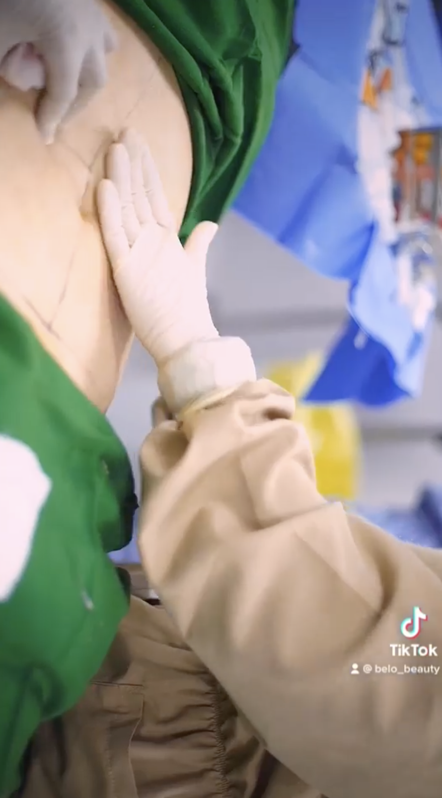 Belo 360 Liposuction