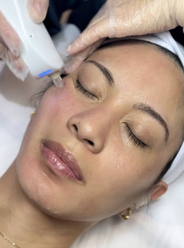Tornado Pore Cleansing Facial