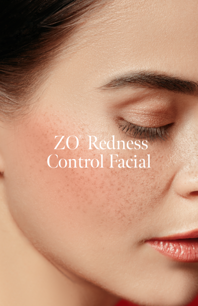 ZO Redness Control Facial