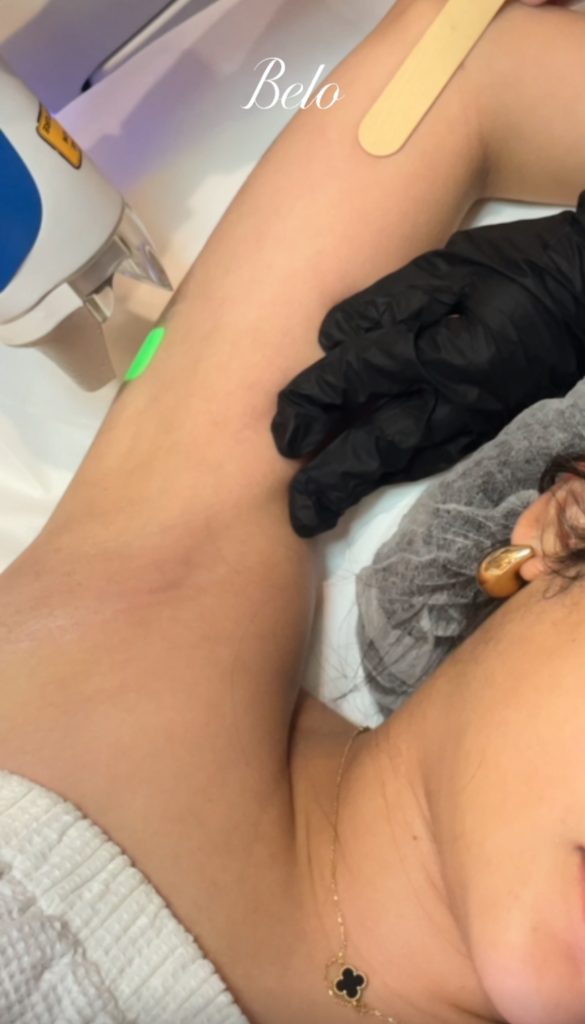 Belo Underarm Splendor X