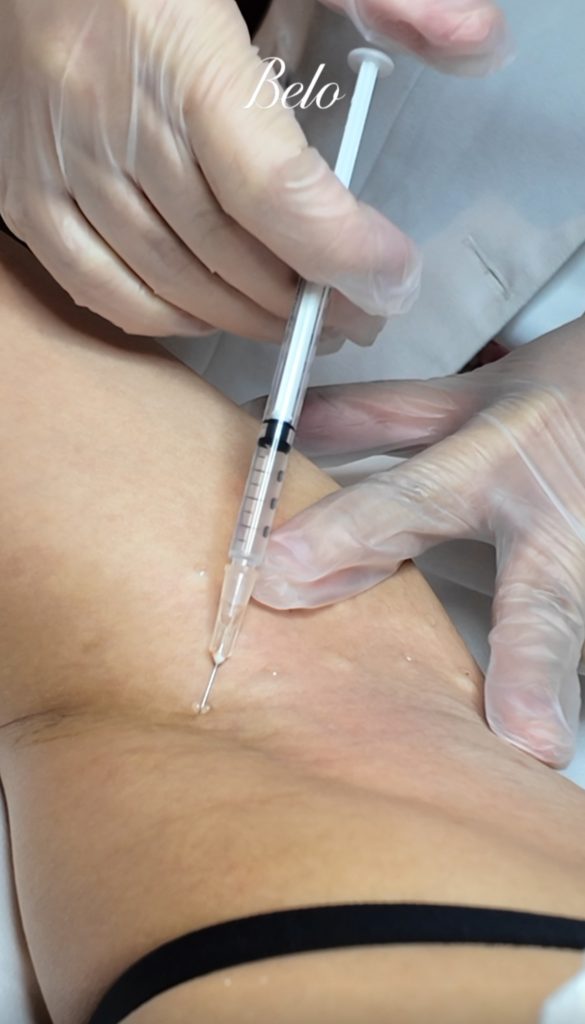 Belo Underarm Sweatox