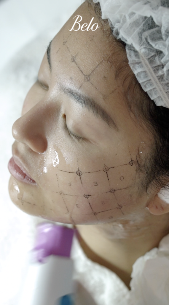 Rei Germar does Thermage FLX