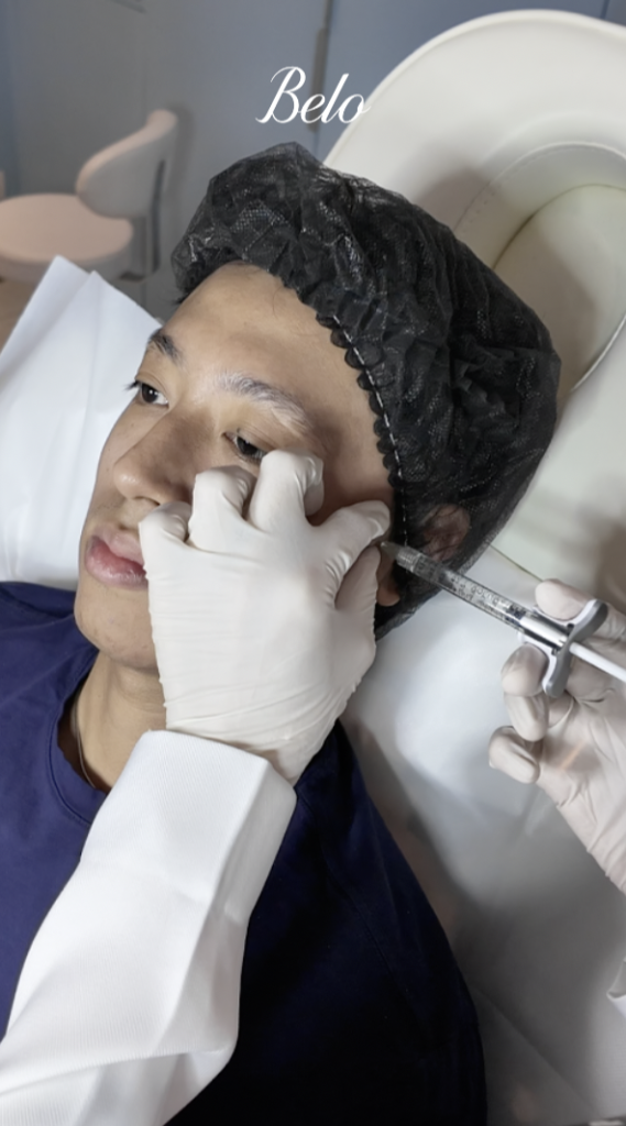 Migy Romulo for Belo Fillers treatment