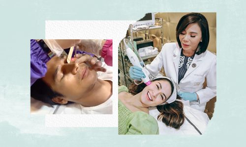 2020 bestselling belo treatments