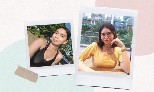 i-got-chin-fillers-to-reshape-my-receding-chin