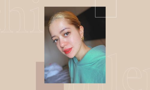 Sue Ramirez chin fillers