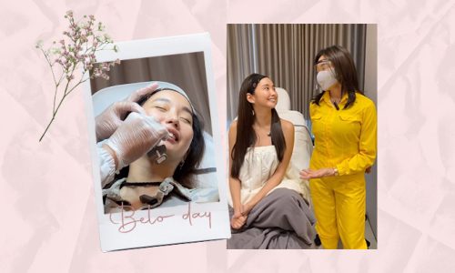 alodia gosiengfiao belo day